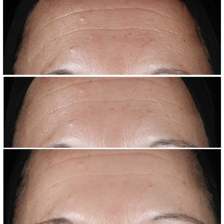 CLINIQUE Smart Clinical Repair Sérum Correcteur Anti-Rides