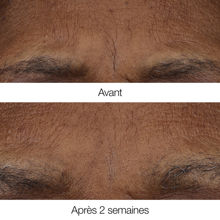 Smart Clinical Repair™ Baume Rétinoïde Anti-Rides