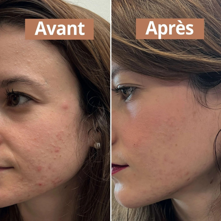 Anti-Imperfections Sérum Visage