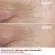 Total Eye Lift - Contour des Yeux Anti-Âge  Soin yeux anti-rides Rechargeable